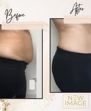 New Image Anti Aging & Weight Loss Center image 9