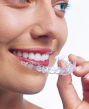 unsichtbare Zahnstellungkorrektur