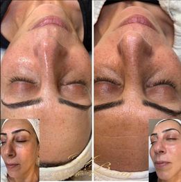 Yade Beauty Liestal