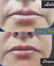 Pies y Manos imagen 4