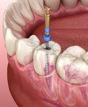 Zahnmedizin Rupperswil Bild 5