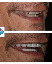 Flawless Smile Dentistry Claremore image 19