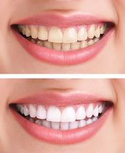 TEAM 15 - PRAXIS FÜR ZAHNMEDIZIN DR. HERMANN & PARTNER Bild 6