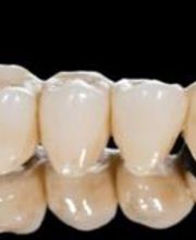 Kronen & Brücken
Dental Team Palace