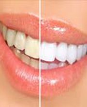 Clínica Implanteoral Milladoiro imagen 18