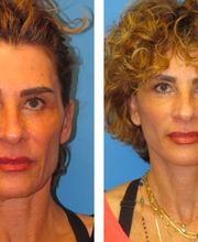 Stephen Bresnick MD image 3