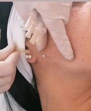 CENTRO ESTÉTICO ESTHER CABALLERO imagen 8