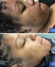 dermani MEDSPA Mansfield image 13