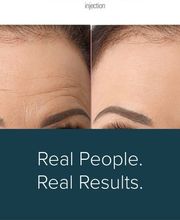 Schweiger Dermatology Group - Glen Carbon image 9