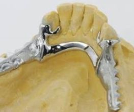 Dentallabor Christian Stroehl Bild 3