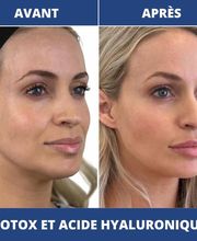 Dr Philippe Legaillard | Chirurgien esthétique Bordeaux | Lifting | Paupières | Rhinoplastie | Augmentation mammaire | Botox image 12