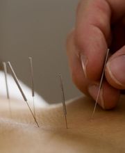 Sinocare Praxis für chinesische Medizin Bild 5