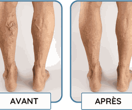 Centre Angiologie Champel Sàrl Bild 6