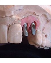 Dentalstudio Peter Häupler e.K. Bild 4