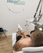 ENDLICH OHNE Tattooentfernung Filiale Bremen Bild 2
