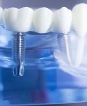 Praxis für Zahnheilkunde Emanuel Schaller Bild 5