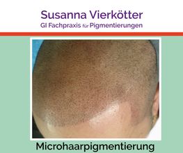 Microhaar Pigmentierung 068