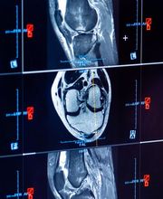 Dr. Lins | Ihre MRT Radiologie Privatpraxis Stuttgart | Schnelle Termine Vorsorge und mehr Bild 12