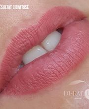 DERM UP image 1