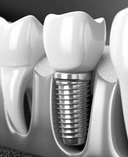 Dentallabor Grüttner GmbH Bild 7