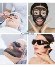 Cosmediq:
Carbon Laser Peeling behandeling