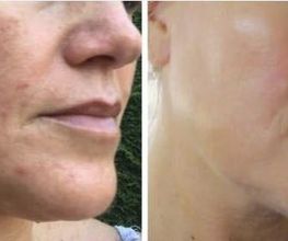 Verschil door inname Eqology Pure Artic Oil visolie supplement