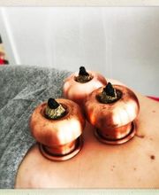 Balea Borealis ventouses moxibustion