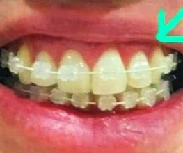 Clínica Dental Quart imagen 4