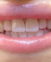 Clínica Dental Vitaldent imagen 4