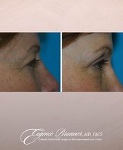 Eugenie Brunner, MD, FACS image 15