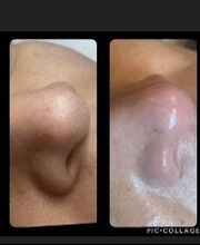 Dinastétique esthéticienne visagiste dermographe image 17