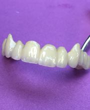 B2C Prothèses Dentaires image 1