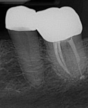 Gildner Family Dentistry of Lexington image 5