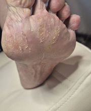 PodoAkitve Berlin Bild 21