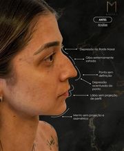 Instituto Marzola | Harmonização Facial imagen 15