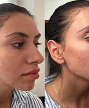 Beautyexperience Lejla GmbH Bild 1