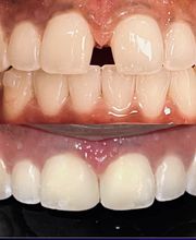 Northeast Lincoln Family Dentistry image 4