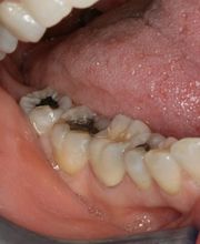 TERAN Dental Co. image 19