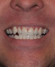 Providence Dental Spa | East Cobb image 4