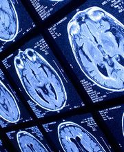 Psicología Amorebieta imagen 5