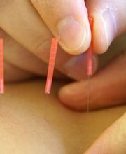 OnePhysio Physiotherapie/Laufschule/Skillcourttraining Kreuzlingen Bild 13