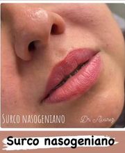 Theys Belleza imagen 4