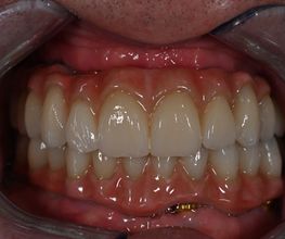 ModeLab Dental Bild 8