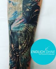 ENDLICH OHNE Tattooentfernung Filiale Bonn Bild 6