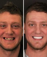 Britely Dentures + Implants Studio image 8