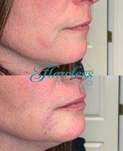 Flawless Med Spa image 2