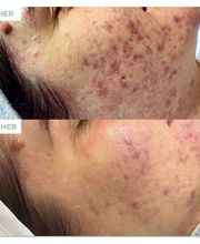 Bellaroba Lilly Bild 5