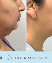 Sonterra Dermatology image 12