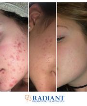 Radiant Dermatology & Aesthetics - Cleveland image 5