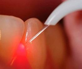 Studio Dentistico Dr. Coler SA Bild 7